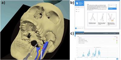 The interactive medical simulation toolkit (iMSTK): an open source platform for surgical simulation